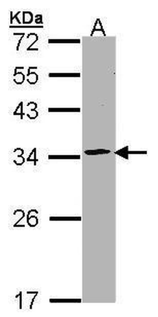 PSMA1 Antibody in Western Blot (WB)