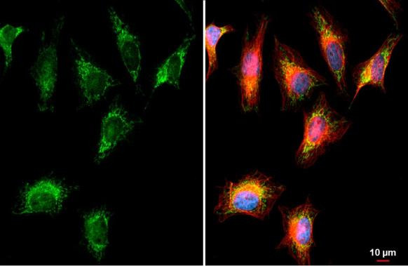 BCKDK Antibody in Immunocytochemistry (ICC/IF)