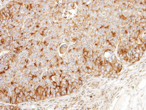 BCKDK Antibody in Immunohistochemistry (Paraffin) (IHC (P))