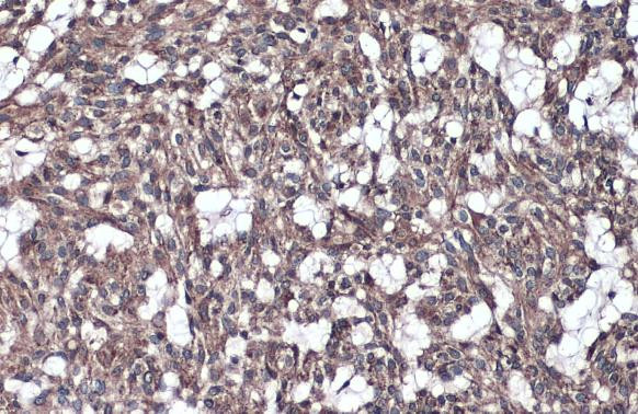 IL-1RAcP Antibody in Immunohistochemistry (Paraffin) (IHC (P))