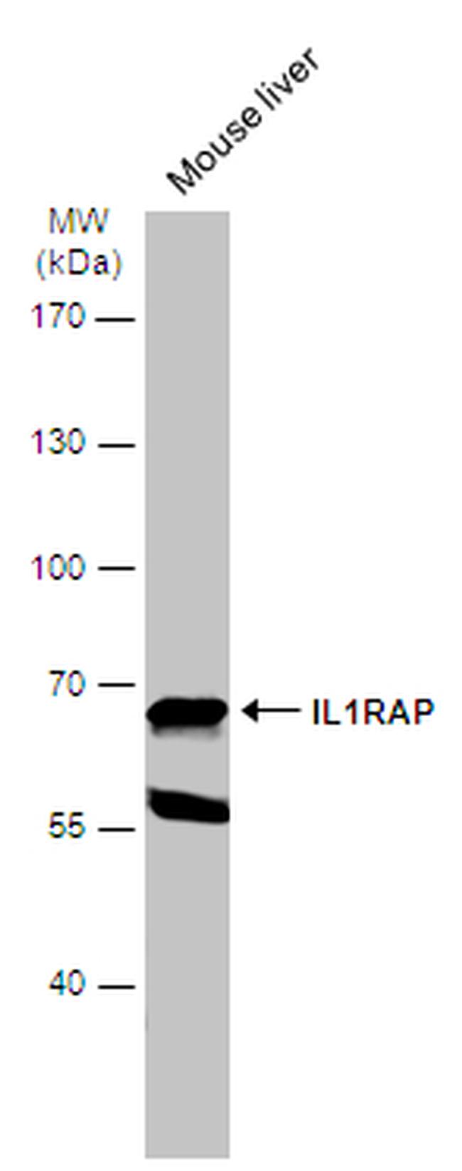 IL-1RAcP Antibody in Western Blot (WB)