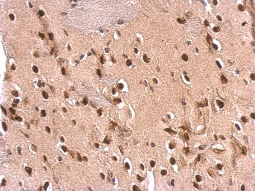 ETS2 Antibody in Immunohistochemistry (Paraffin) (IHC (P))