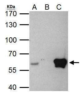 ETS2 Antibody in Immunoprecipitation (IP)