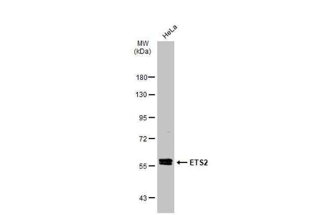 ETS2 Antibody in Western Blot (WB)