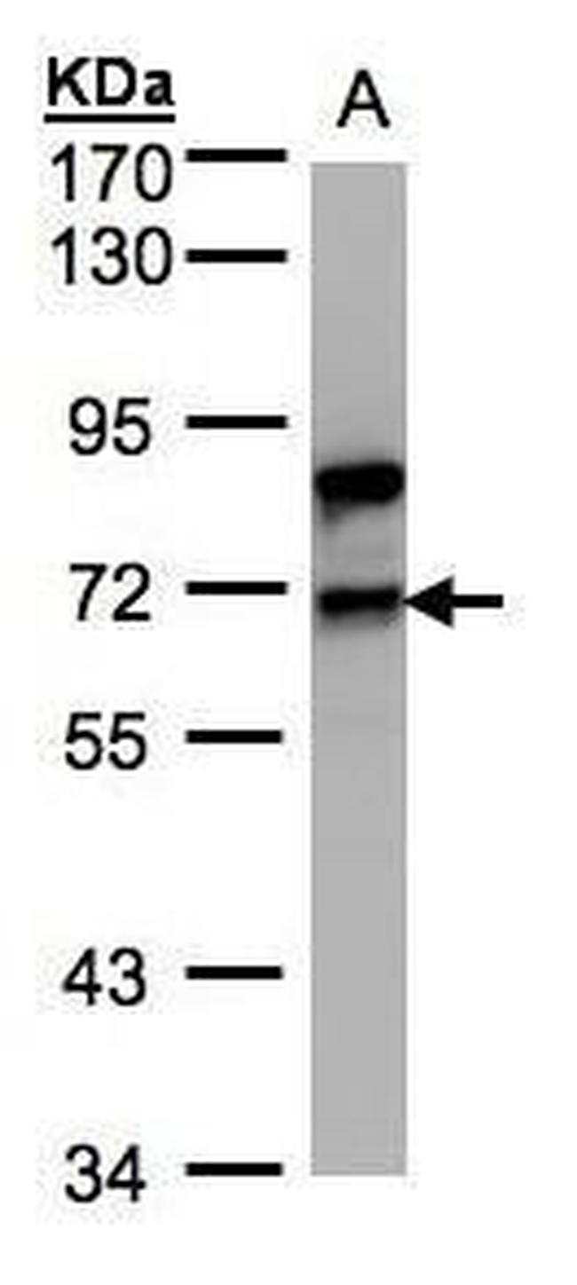 SF1 Antibody in Western Blot (WB)