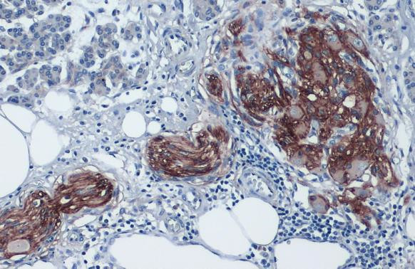 Glypican 1 Antibody in Immunohistochemistry (Paraffin) (IHC (P))