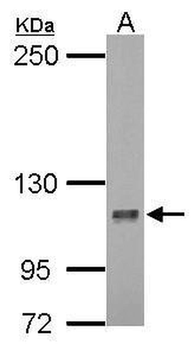 DLG7 Antibody in Western Blot (WB)