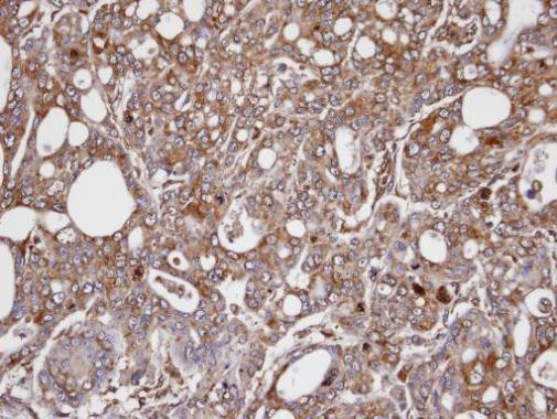 AKR1C3 Antibody in Immunohistochemistry (Paraffin) (IHC (P))