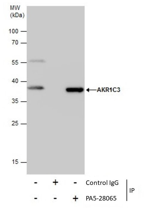 AKR1C3 Antibody in Immunoprecipitation (IP)