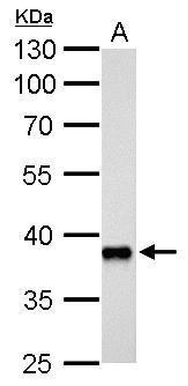 AKR1C3 Antibody in Western Blot (WB)