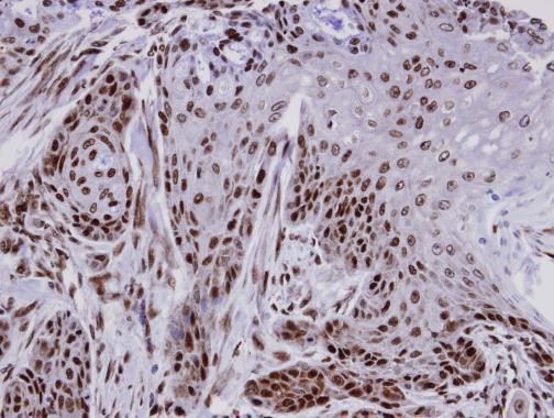 FCP1 Antibody in Immunohistochemistry (Paraffin) (IHC (P))