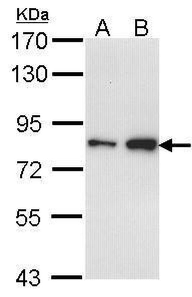 FCP1 Antibody in Western Blot (WB)