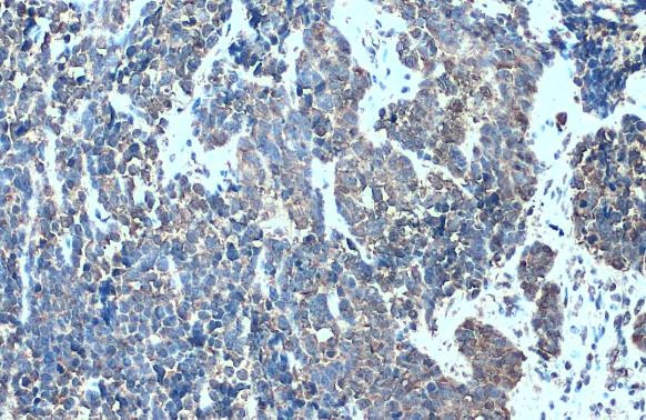 MMP7 Antibody in Immunohistochemistry (Paraffin) (IHC (P))