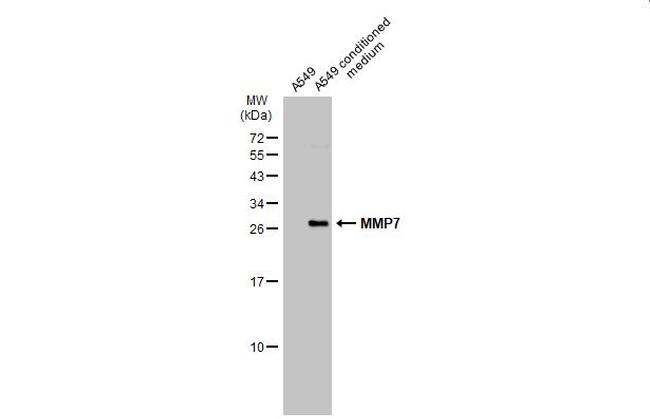 MMP7 Antibody in Western Blot (WB)