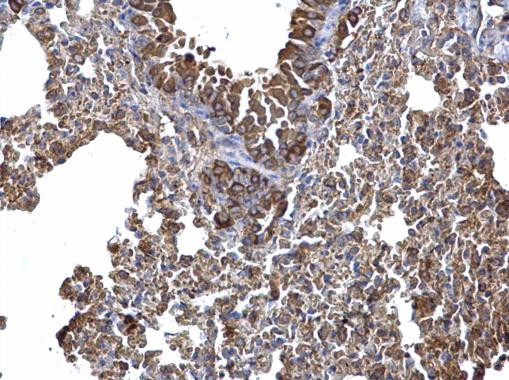 AID Antibody in Immunohistochemistry (Paraffin) (IHC (P))