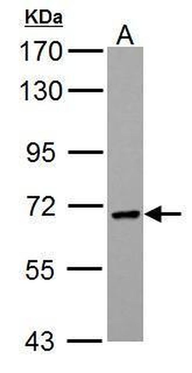 PCK2 Antibody in Western Blot (WB)