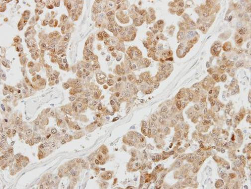 PSMB5 Antibody in Immunohistochemistry (Paraffin) (IHC (P))