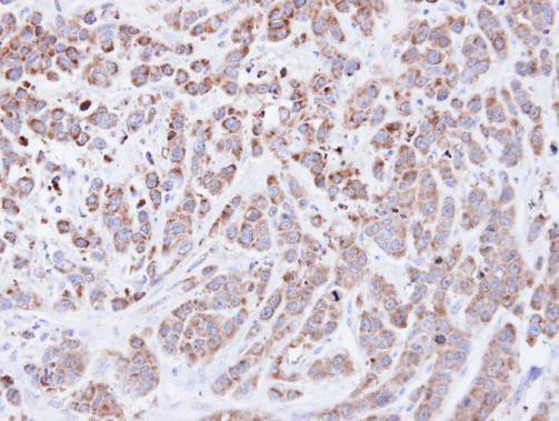 Cyclophilin A Antibody in Immunohistochemistry (Paraffin) (IHC (P))