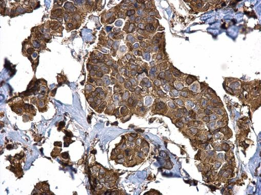 Stathmin 1 Antibody in Immunohistochemistry (Paraffin) (IHC (P))