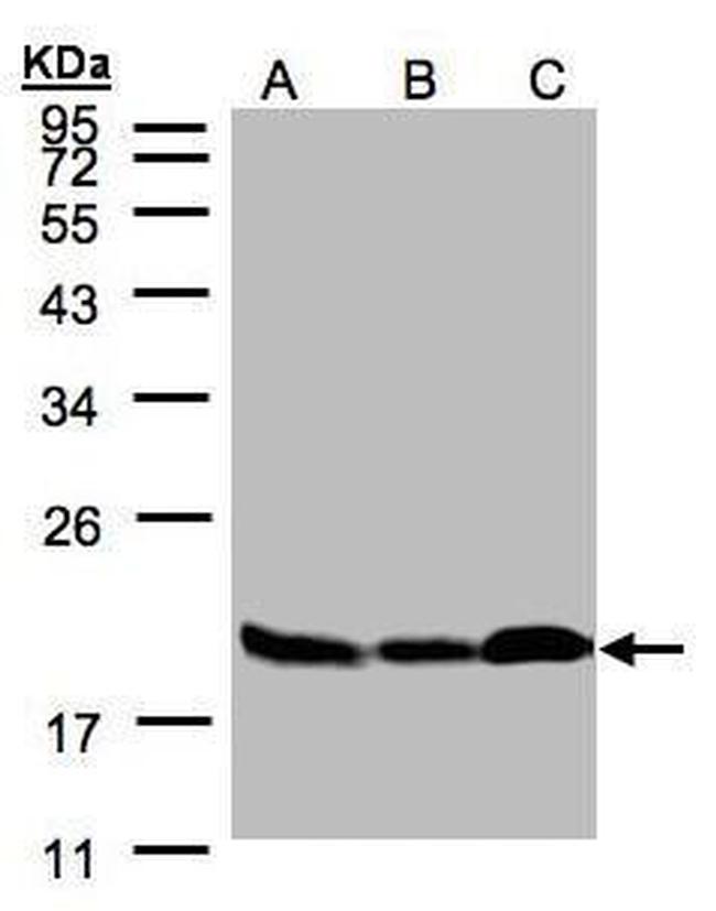 Stathmin 1 Antibody in Western Blot (WB)