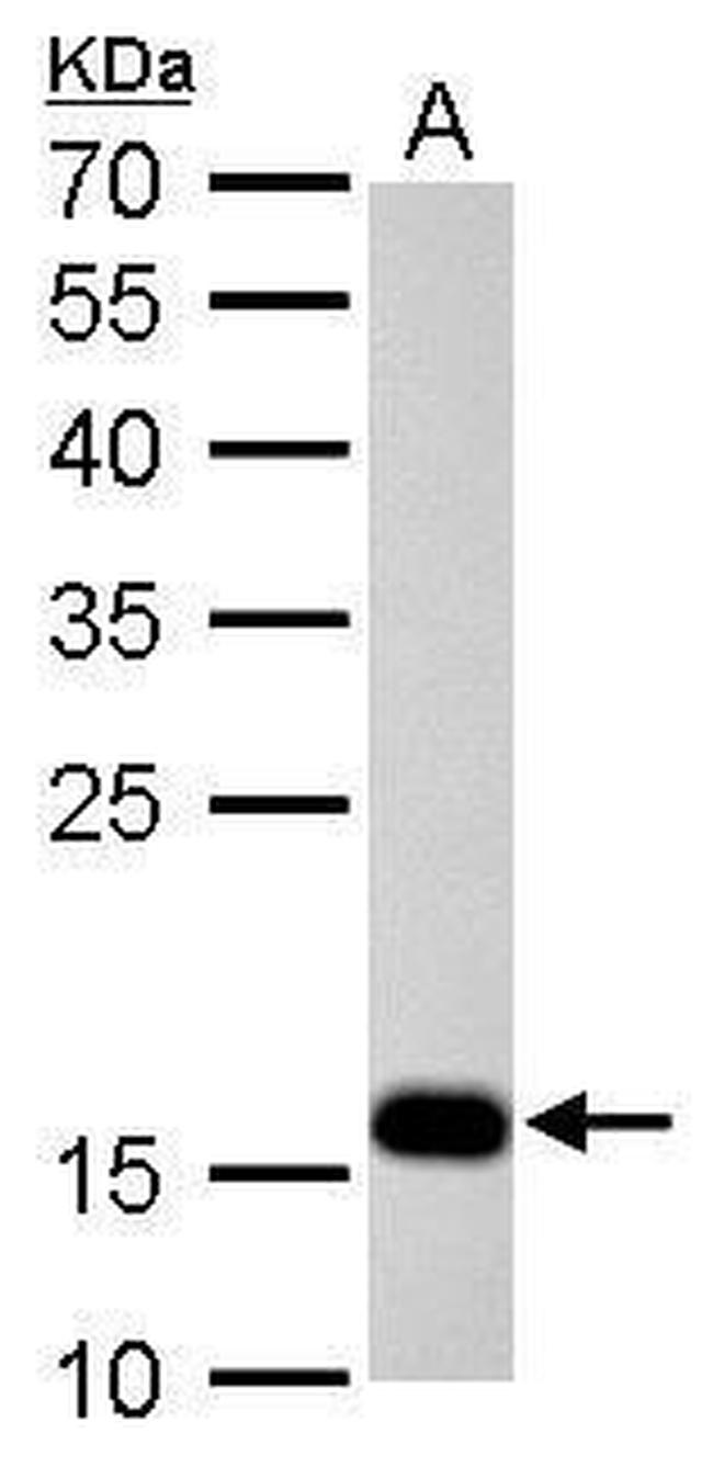 Stathmin 1 Antibody in Western Blot (WB)