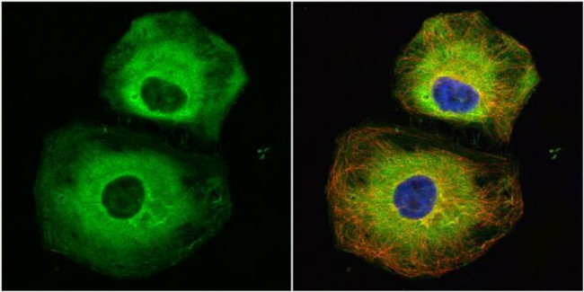 Stathmin 1 Antibody in Immunocytochemistry (ICC/IF)