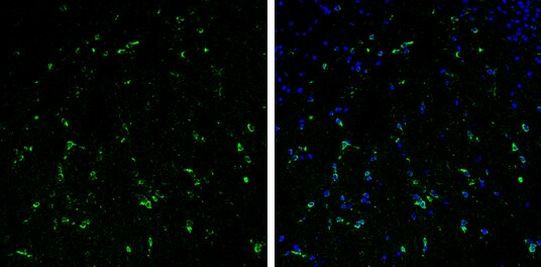 Stathmin 1 Antibody in Immunohistochemistry (Frozen) (IHC (F))