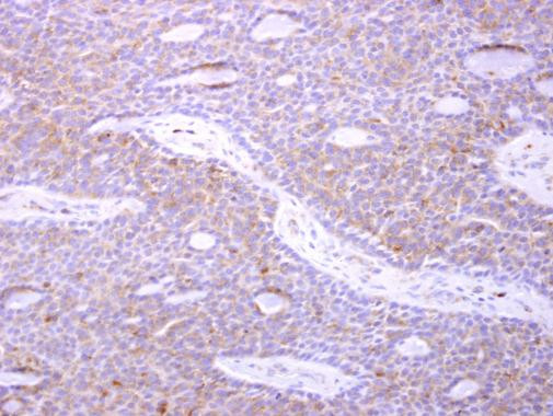 p41-ARCb Antibody in Immunohistochemistry (Paraffin) (IHC (P))