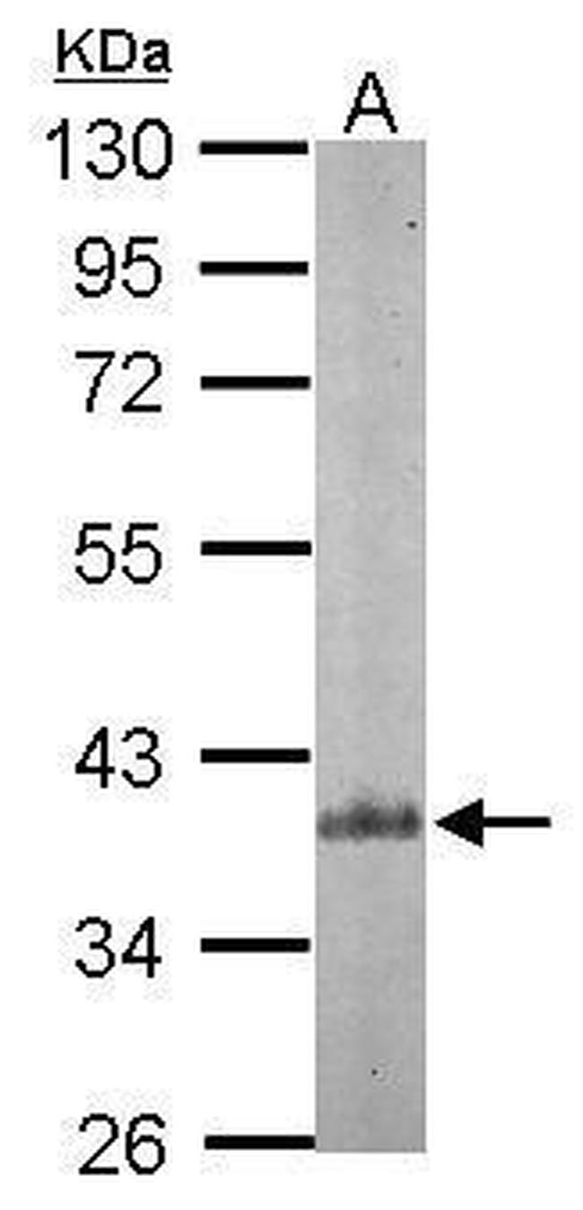 p41-ARCb Antibody in Western Blot (WB)