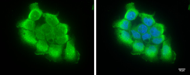 TRIF Antibody in Immunocytochemistry (ICC/IF)