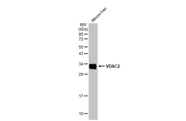 VDAC2 Antibody in Western Blot (WB)