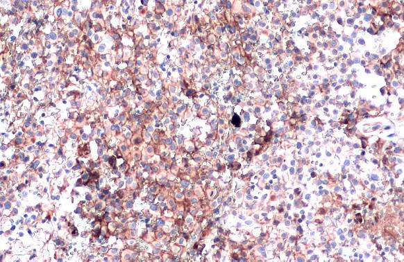 PD-L1 Antibody in Immunohistochemistry (Paraffin) (IHC (P))