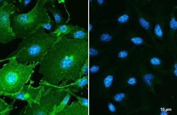 PD-L1 Antibody in Immunocytochemistry (ICC/IF)