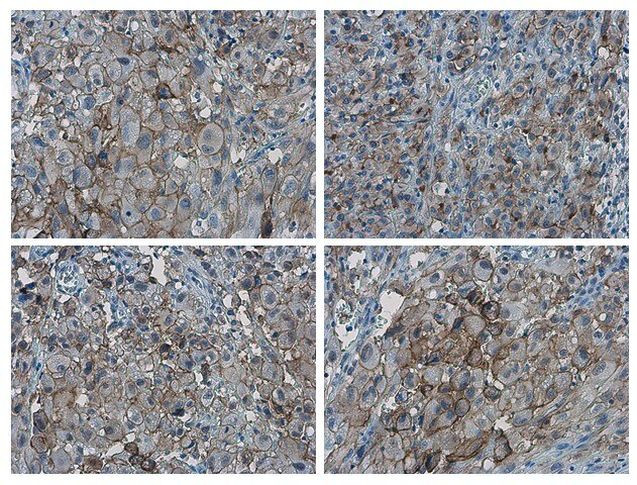 PD-L1 Antibody in Immunohistochemistry (Paraffin) (IHC (P))