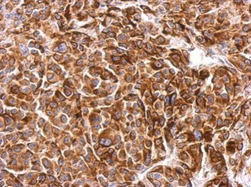 SIPA1 Antibody in Immunohistochemistry (Paraffin) (IHC (P))