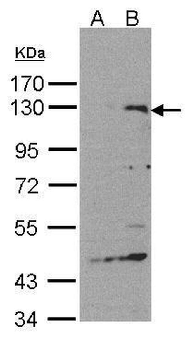 SIPA1 Antibody in Western Blot (WB)