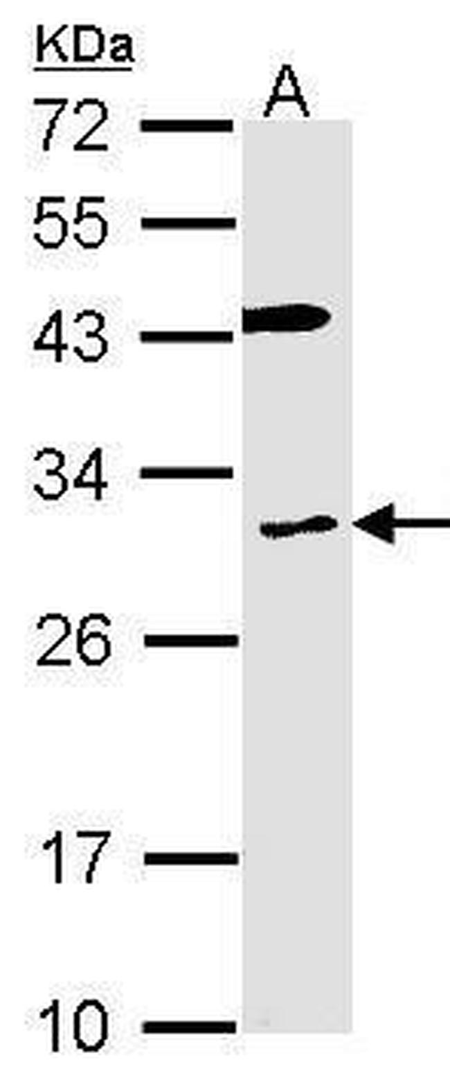CYBRD1 Antibody in Western Blot (WB)
