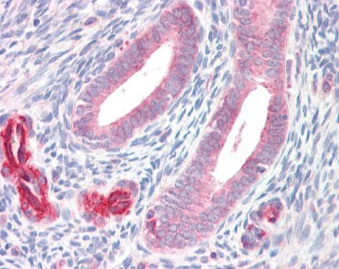 ADAM33 Antibody in Immunohistochemistry (Paraffin) (IHC (P))