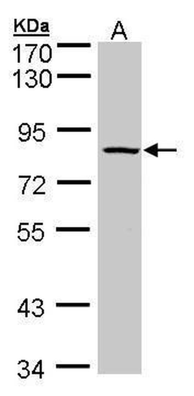 ADAM33 Antibody in Western Blot (WB)