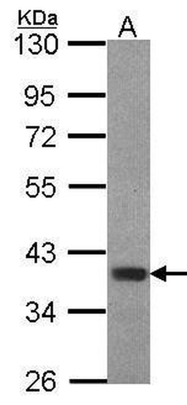 FOXB1 Antibody in Western Blot (WB)