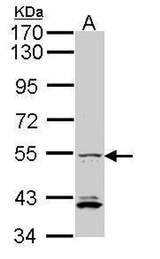 IRF5 Antibody in Western Blot (WB)