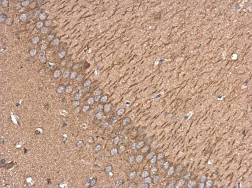 Kinesin 5A Antibody in Immunohistochemistry (Paraffin) (IHC (P))