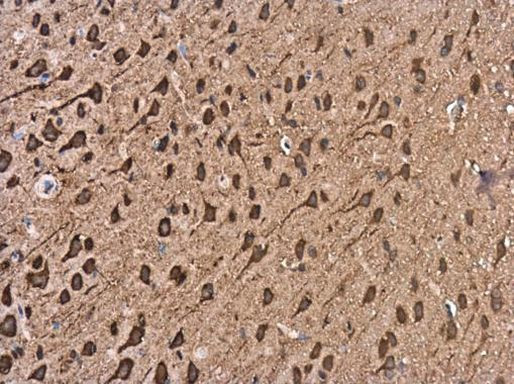 Kinesin 5A Antibody in Immunohistochemistry (Paraffin) (IHC (P))