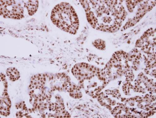 ZNF148 Antibody in Immunohistochemistry (Paraffin) (IHC (P))