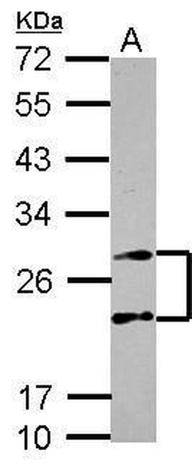 PSMA4 Antibody in Western Blot (WB)