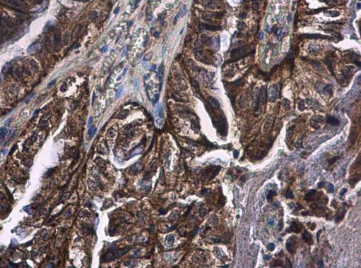 FCAR Antibody in Immunohistochemistry (Paraffin) (IHC (P))