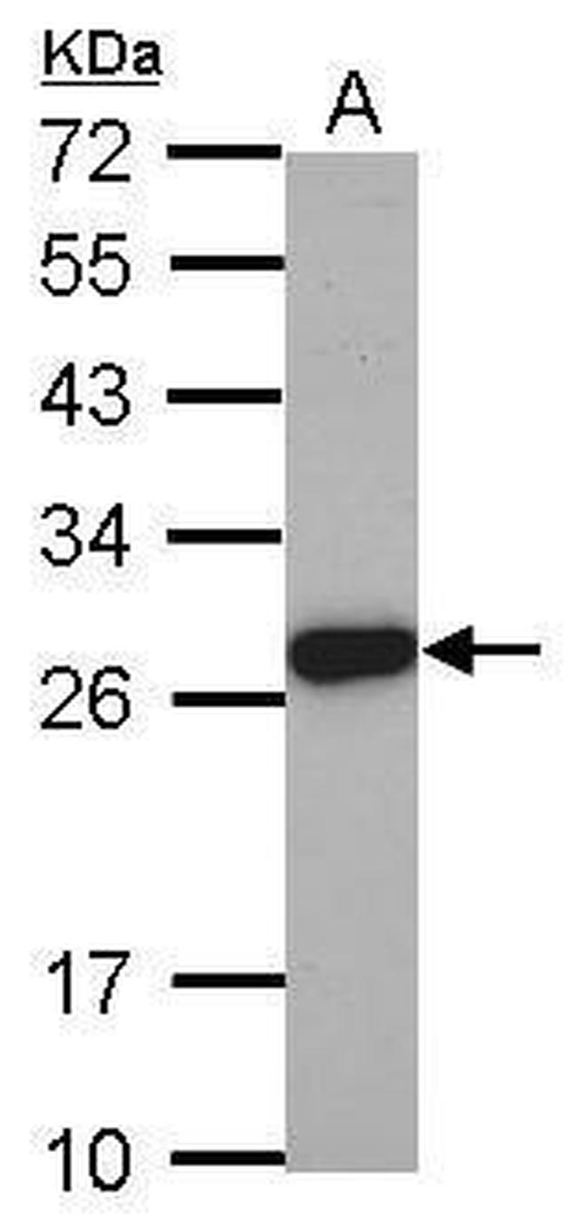 ELA3A Antibody in Western Blot (WB)