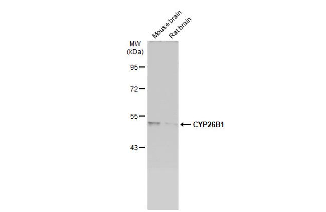 CYP26B1 Antibody in Western Blot (WB)