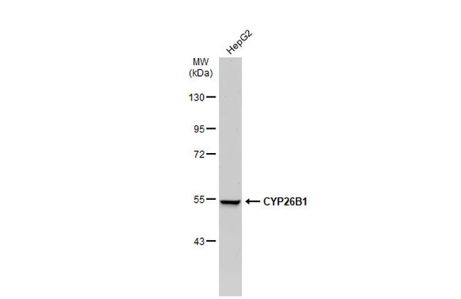 CYP26B1 Antibody in Western Blot (WB)