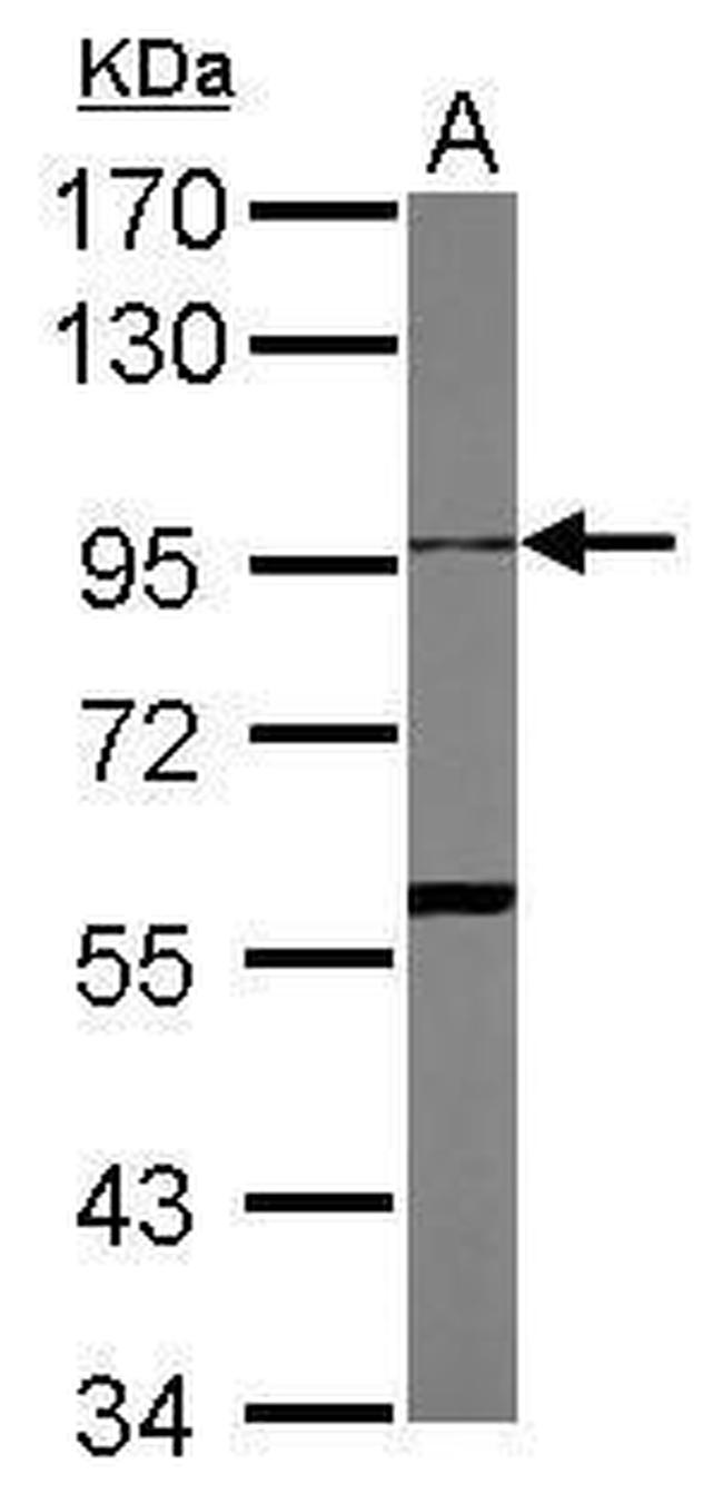 ADAM10 Antibody in Western Blot (WB)